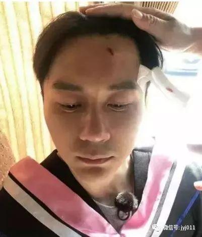 李晨爆料李四最新视频播放,播放量惊人！